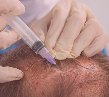 Doenças dos cabelos