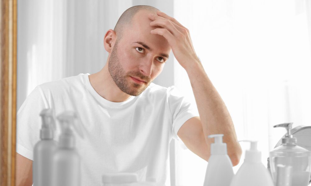 Homem careca olhando para espelho e com a mão na testa