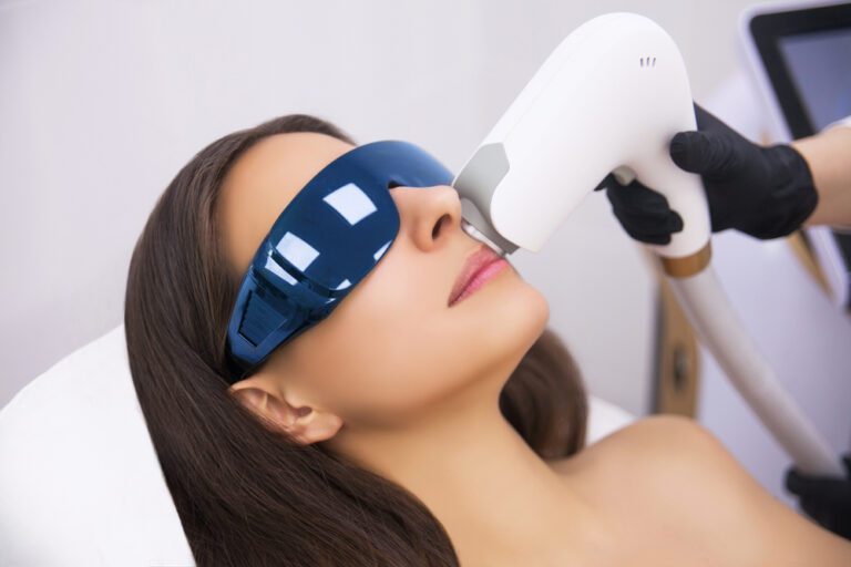 Imagem ilustrativa de aplicação de luz intensa pulsada em uma mulher